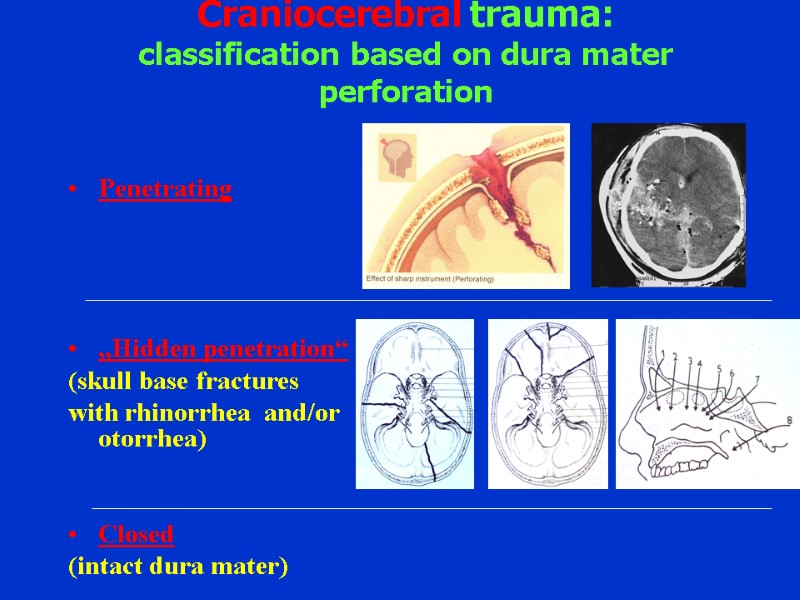 Craniocerebral trauma: classification based on dura mater perforation Penetrating     „Hidden